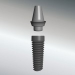 Implantatpfosten - Zahnimplantat Aufbau - Zahnarztpraxis Dr. Witteler & Steinker