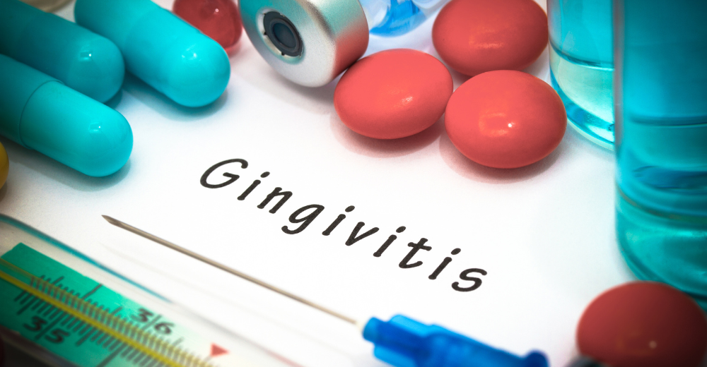 Diagnose Gingivitis bei Dr. Witteler & Steinker in Münster